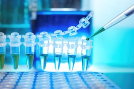 Proben werden für die Polymerase-Kettenreaktion vorbereitet. Bild zeigt: Eine Reihe von Eppis, die gerade mit einer Pipette gefüllt werden